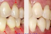 Mavendents Dental clinic Shapoorji