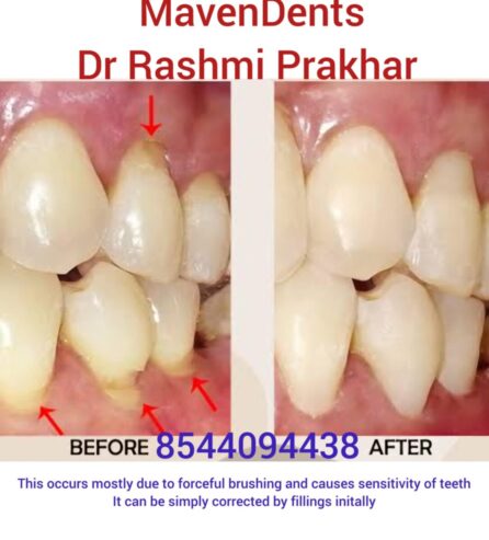 Mavendents Dental clinic Shapoorji
